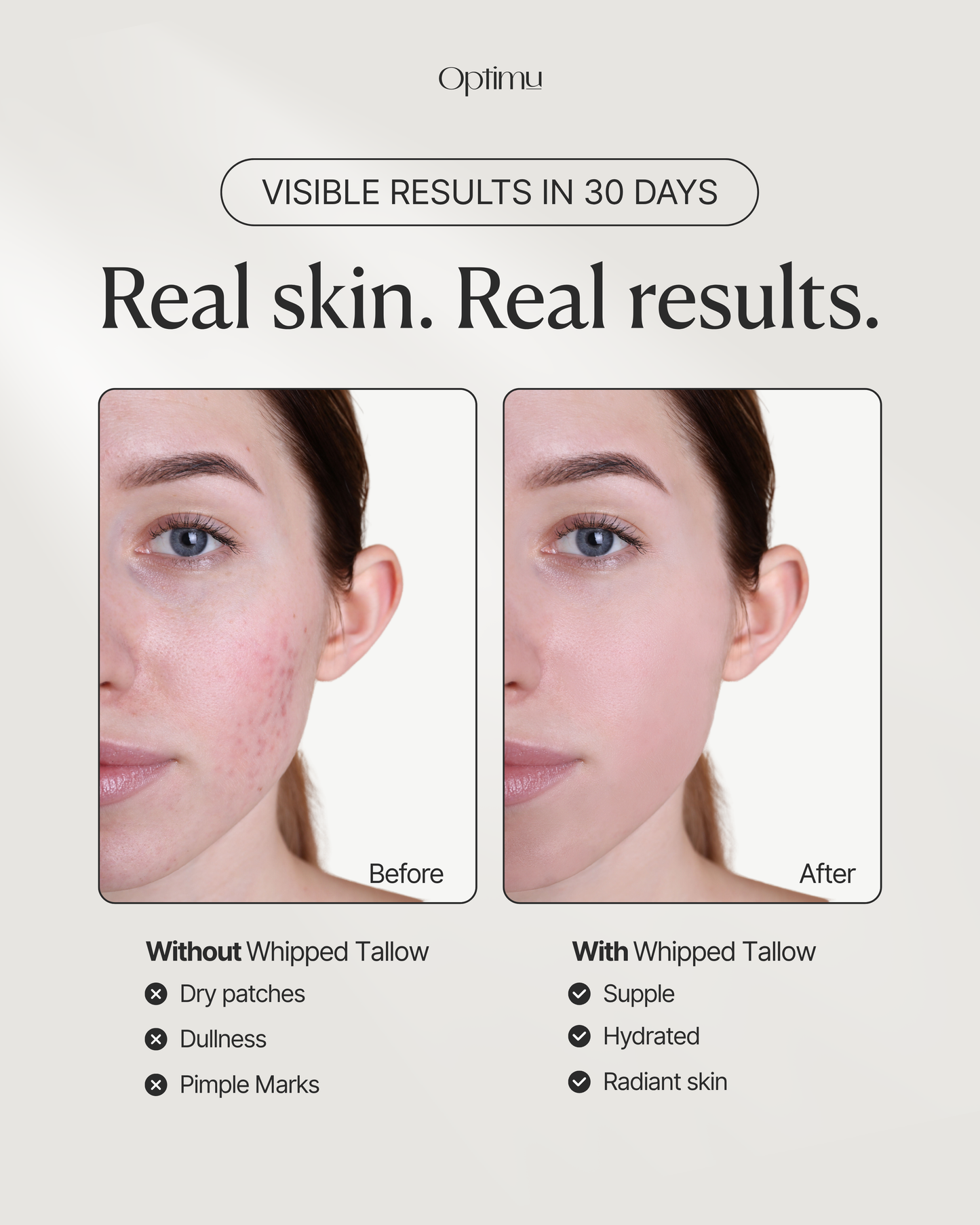 Skin Replenish Balm | Spa soft skin, balanced glow, one whipped step